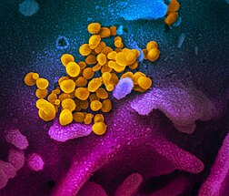 Vue au microscope électronique à balayage d’un groupe de SARS-CoV-2 (en jaune), le virus qui cause la maladie Covid-19 - ici isolé d'un patient aux États-Unis, émergeant de la surface de cellules (bleues / roses) cultivées en laboratoire.