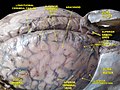 Meningele și venele cerebrale superficiale. Disecție profundă. Vedere superioară